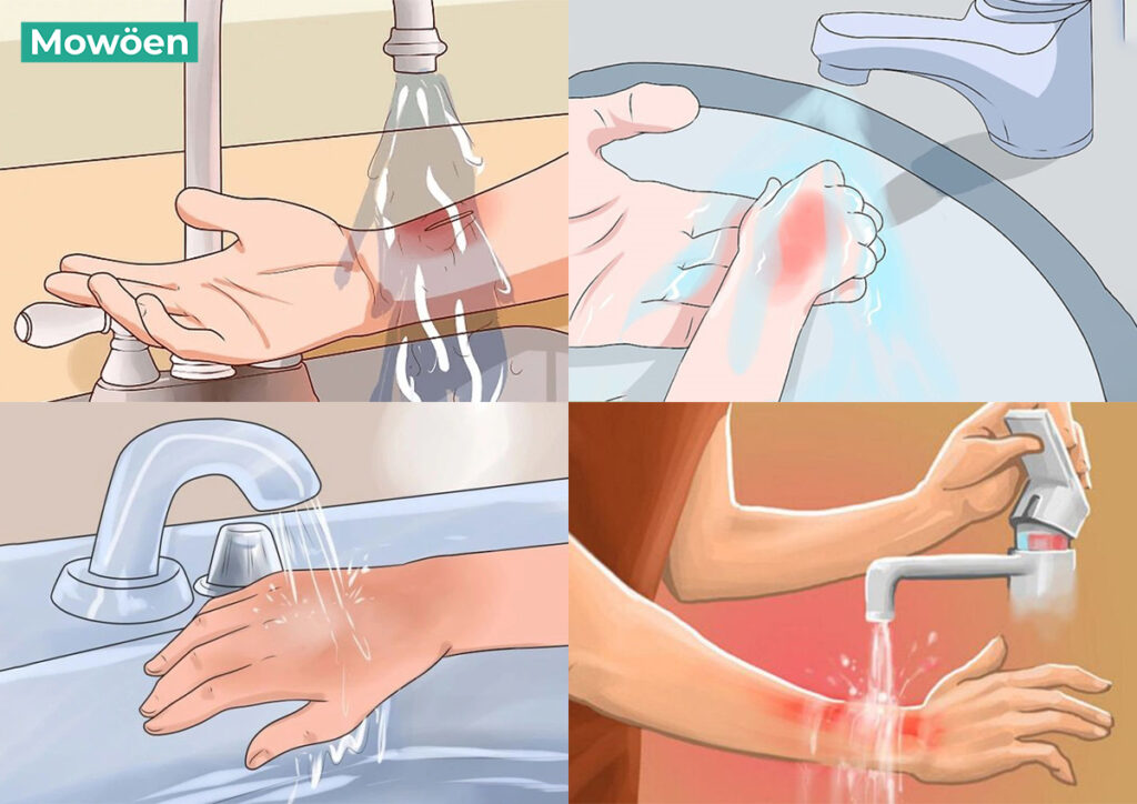 Nguy cơ nước nóng trong phòng tắm làm bỏng da